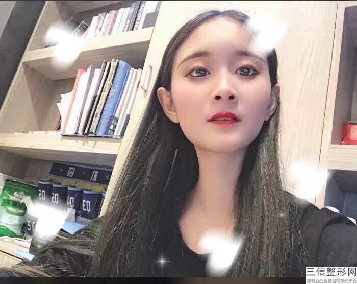 激光脱腋毛要花多少钱价格？激光脱毛怎么样