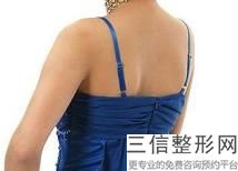 手臂吸脂多少钱,胳膊抽脂多少钱？