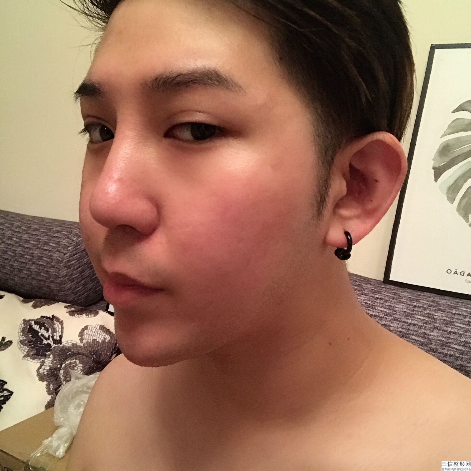 达拉斯美鼻多少钱,达拉斯全鼻整形大概多少钱？