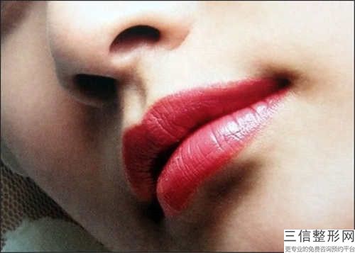 杭州嘴唇疤痕修复手术价格的3个因素