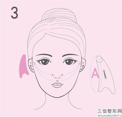 南京市淡化皱纹医院排行前十名单2023版（南京市淡化皱纹整形医院）