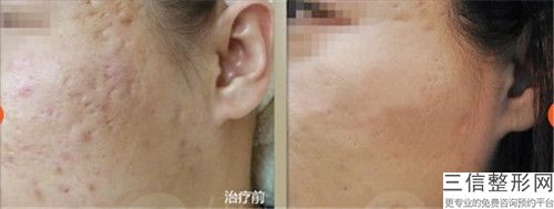 河源市激光祛老年斑医院top10排名一个不落(河源市激光祛老年斑整形医院)
