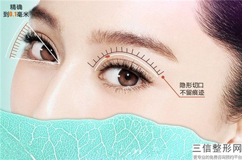 乌兰察布市眼袋术后眼睑凹陷修复整形美容科价格表（费用清单）发布(10月-4月均价为：7556元)