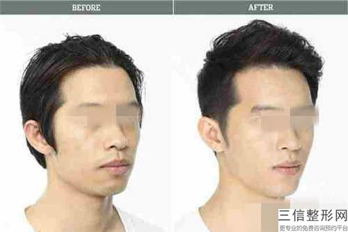通化市唇部外翻矫正整形美容科价格表（收费标准）2023版(近6个月均价为：10111元)