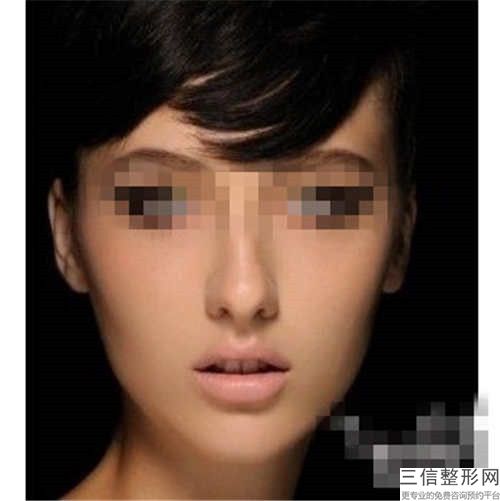 2023年乌兰察布市玻尿酸注射丰唇医院排行前十强较新版本(乌兰察布市玻尿酸注射丰唇整形医院)