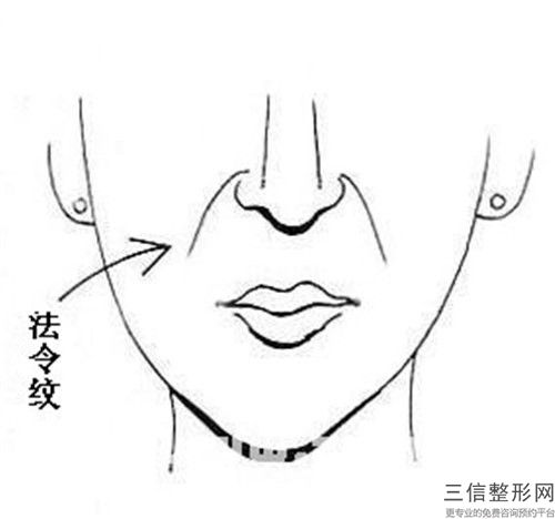 天水市微晶磨削去妊娠纹价格表新版公布-天水市微晶磨削去妊娠纹费用大约多少