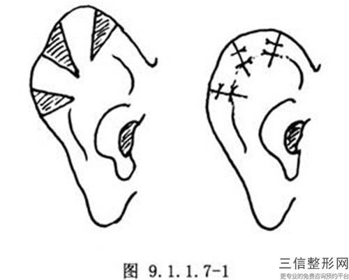 中国人民解放军联勤保障部队第九八〇医院价格(价目)表新抢先看-擅长项目耳轮畸形矫正等