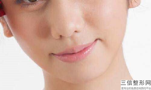 北京紫洁医疗美容唇腭裂整形修复手术常见风险和术后处理