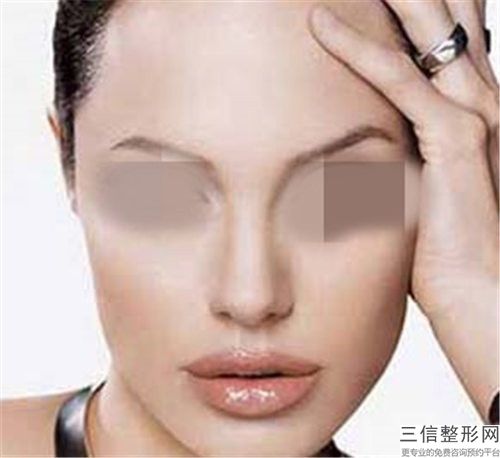 娄底手术唇鼻畸形一次管多久