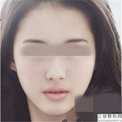 保山市下巴整型整容价格表附2024-保山市下巴整型整容整形价格一般要多少钱