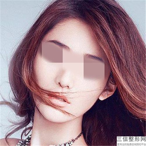 垫下巴脂肪手术医院推荐：垫下巴脂肪医院前30名专个横评