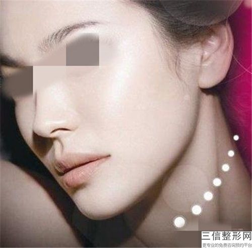 玻尿酸注射下巴整形手术会影响视力吗