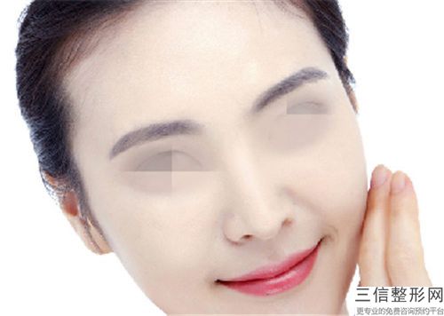 耳软骨隆鼻隆鼻术能保持多久不变形