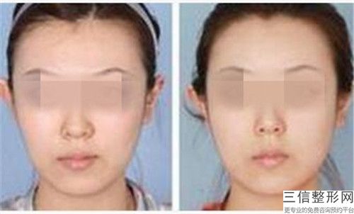 合肥市口腔缺牙导致脸歪纠正医院哪家好-合肥亿立洁口腔门诊部上榜理由重点介绍