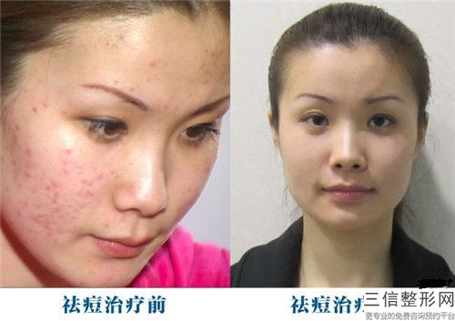南昌大学非常好附属医院整形科,南昌大学非常好附属医院疤痕科口碑严选都是实力派