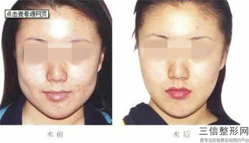 秦淮区专业牙齿咬合反颌牙科医院有那些-南京斯唯尔口腔门诊部大咖实力入围
