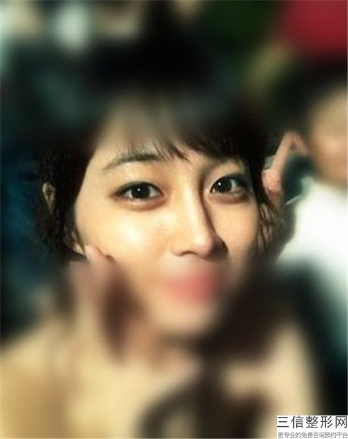 南京医科大学附属口腔医院整形科张珏医生,韩兵医生口碑