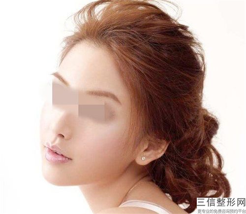 菏泽市体垫下巴医生排名榜top10哪几个技术棒-陈会苓医生口碑评价好医生