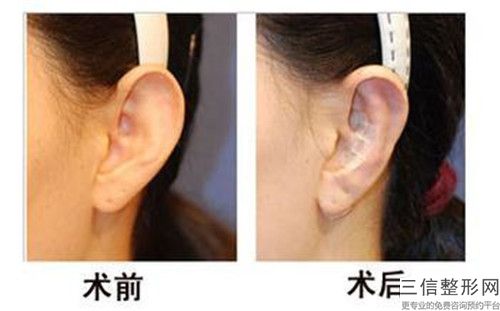 中山市轻度耳朵畸形医院-中山市轻度耳朵畸形医院上榜名单前十位大综合汇总