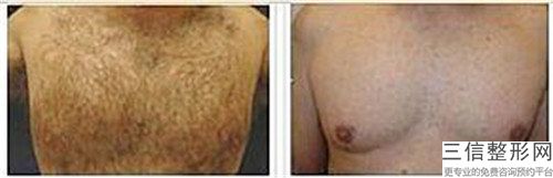 蚌山区韩国登腾种植体医生排名榜前10位白名单发布-蚌山区韩国登腾种植体口腔医生