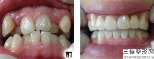 吴江区知名鲍牙矫正牙科有那些（苏州雅易口腔口碑评价反馈）