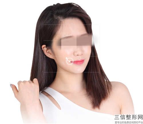国内哪家整形医院盂唇修补术良好:盂唇修补术医院top50实力测评