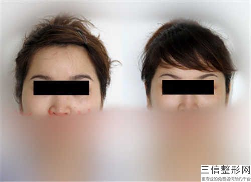 下颌吸脂减肥蕞好的医生国内：下颌吸脂减肥医生前50位新版宣布