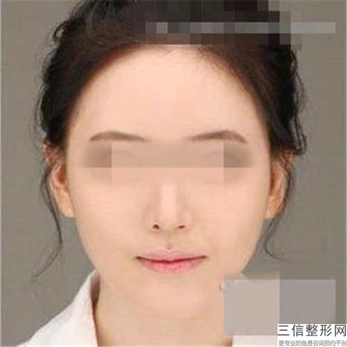 重庆市第四人民医院美容科价格(价目)表2026优惠巨献-擅长项目唇裂去疤痕修复等