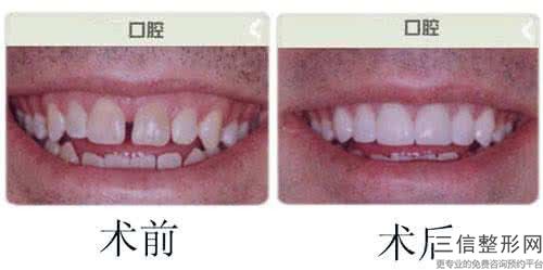 官渡区成年矫正牙医院哪家好还便宜（昆明市口腔医院_一一上榜）
