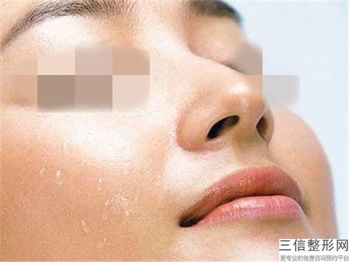 崔鹏达拉斯生态隆鼻手术的六大人群