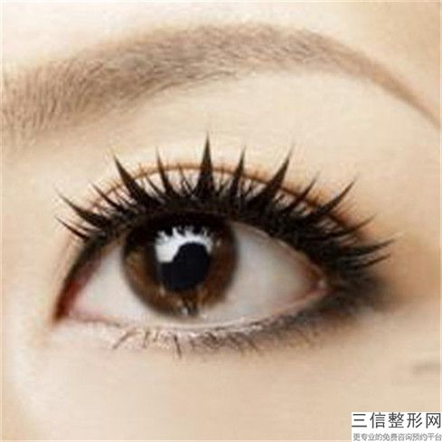 罗定安泪沟眼袋黑眼圈去除手术有什么后遗症吗
